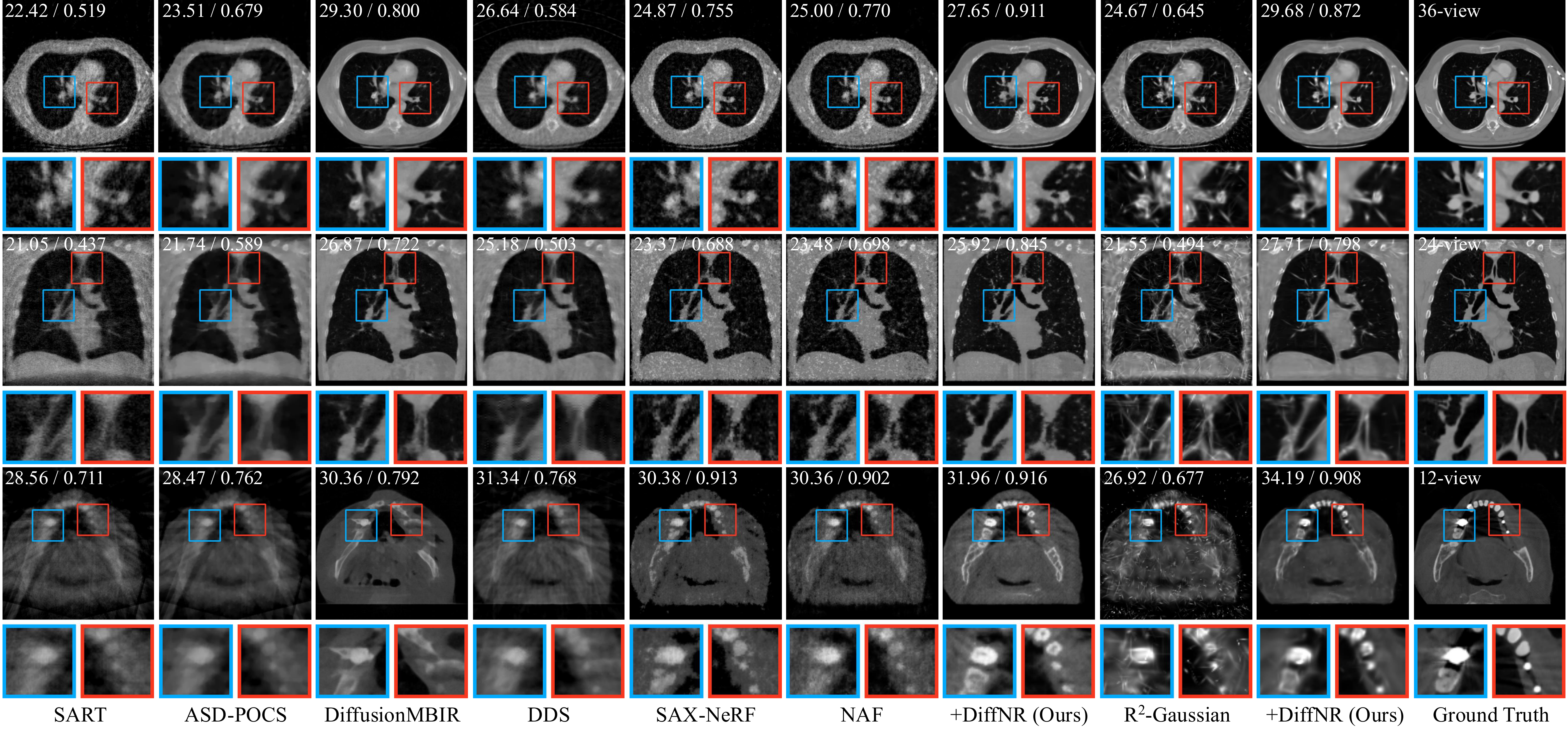 Qualitative comparison across methods, slicing directions, and sparsity levels